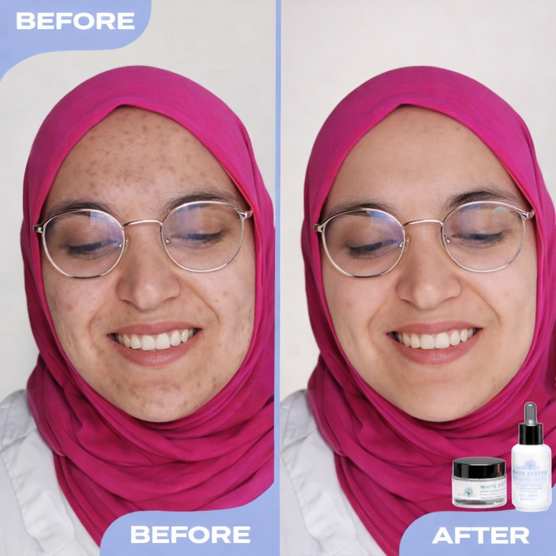Before after image 1