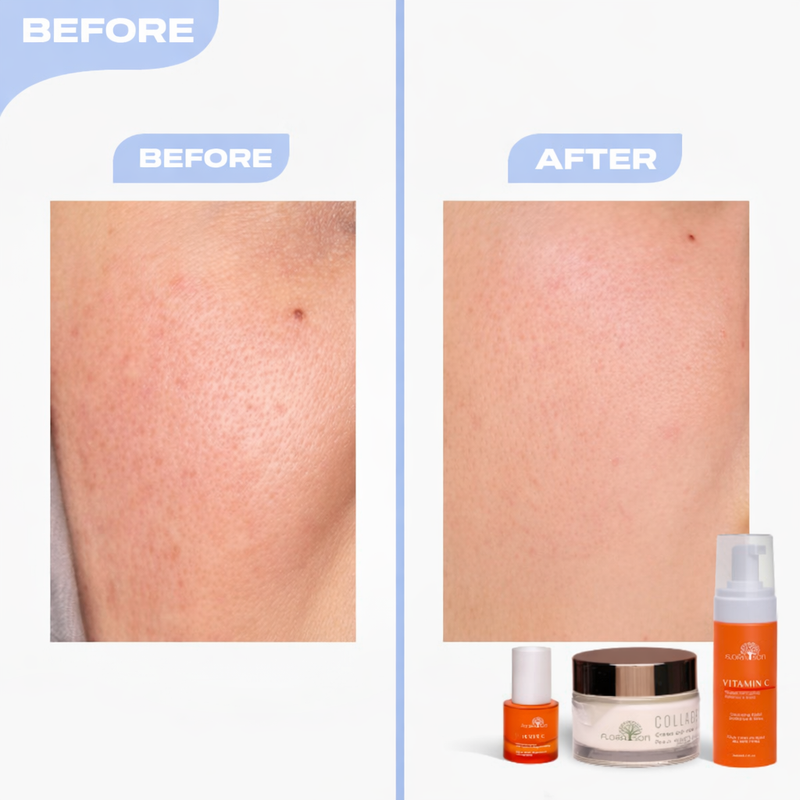 Before after image 4
