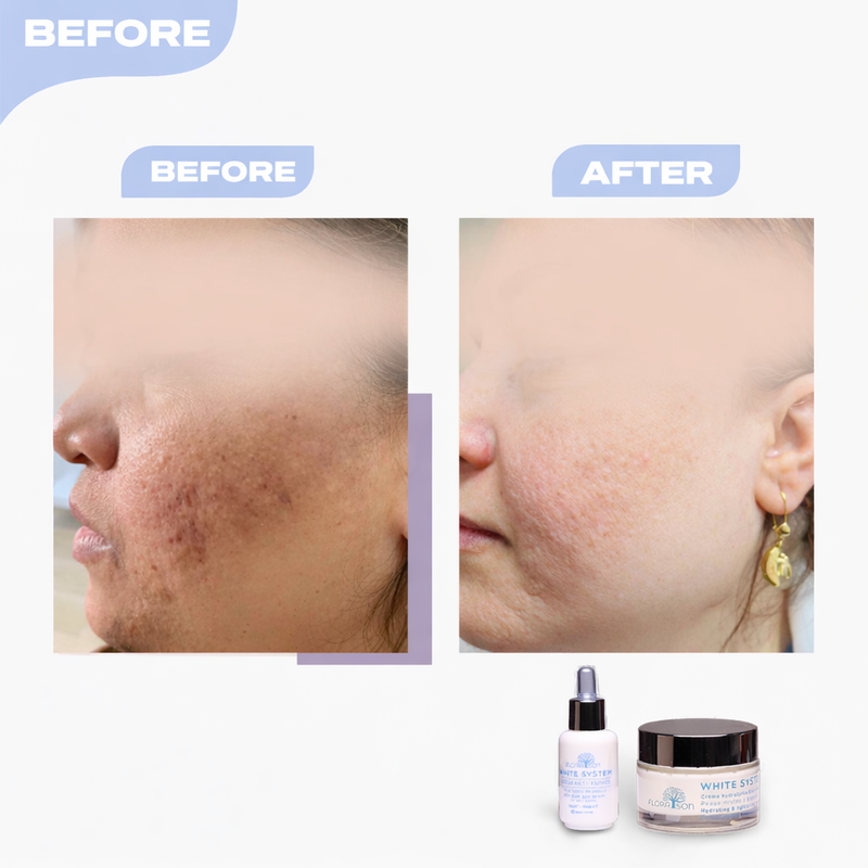 Before after image 3