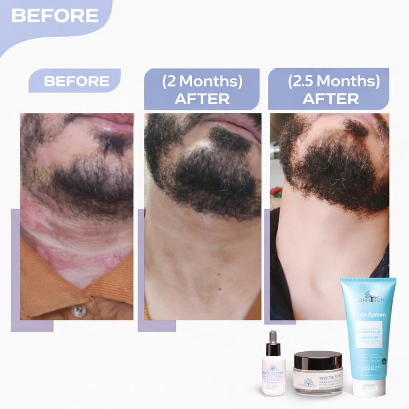 Before after image 2